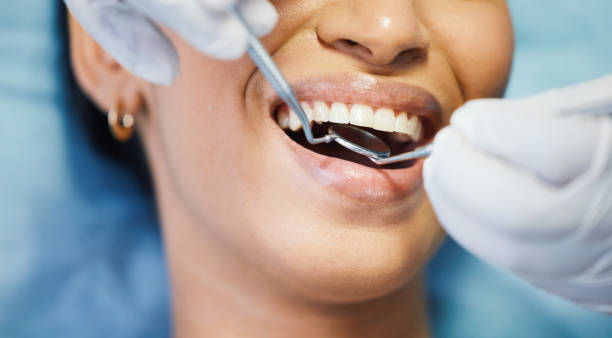 Best Chipped Tooth Repair Near Me  in Canal Winchester, OH