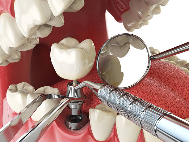 Best Emergency Gum Pain Relief  in Canal Winchester, OH
